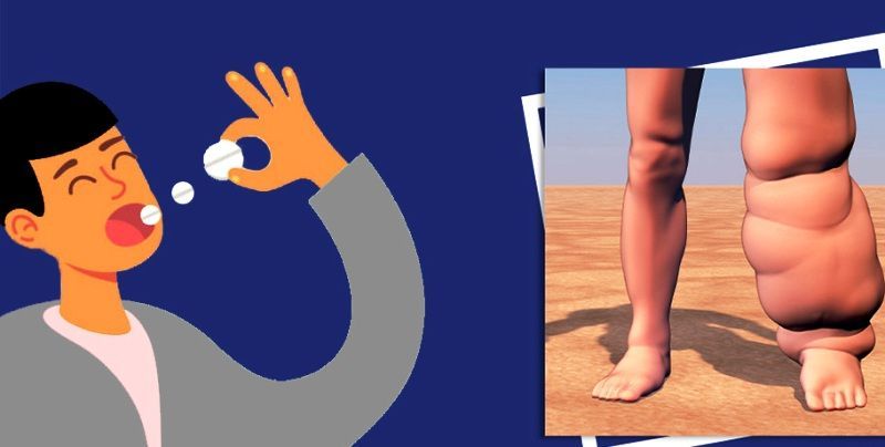 कैलालीमा ८० प्रतिशतले सेवन गरे हात्तीपाइलेको औषधि